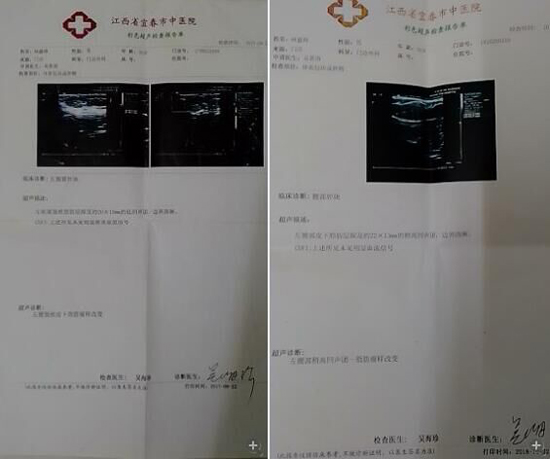 人體植入晶元的技術瓶頸和安全風險不容忽視
